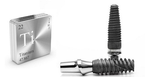TIÊU CHÍ LỰA CHỌN TRỤ IMPLANT TỐT VÀ PHÙ HỢP NHẤT -6