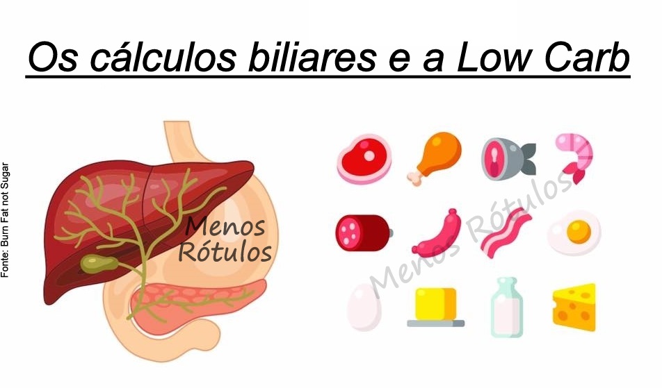 Pedra na vesicula e dieta