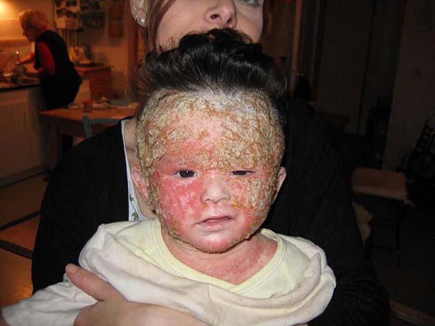 Los CDC admiten que las vacunas contienen células "abortadas de feto humano" fbs serum, celulas madres chile, banco de celulas madre en mexico, curacion con celulas madre, celulas madres para diabeticos, inyecciones de celulas madre, celulas madre artrosis, celulas madres para que sirven, para que sirven, celulas madres, tratamiento de celulas madre, como obtener celulas madre, tratamiento con celulas madre, celulas madres tratamientos medicos, celulas madre medicina regenerativa, laboratorio celulas madre, celulas madre,