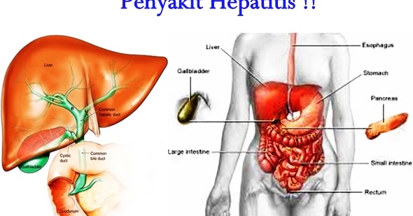 Gejala Penyakit Hepatitis