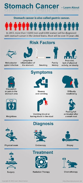 Stomach cancer symptoms