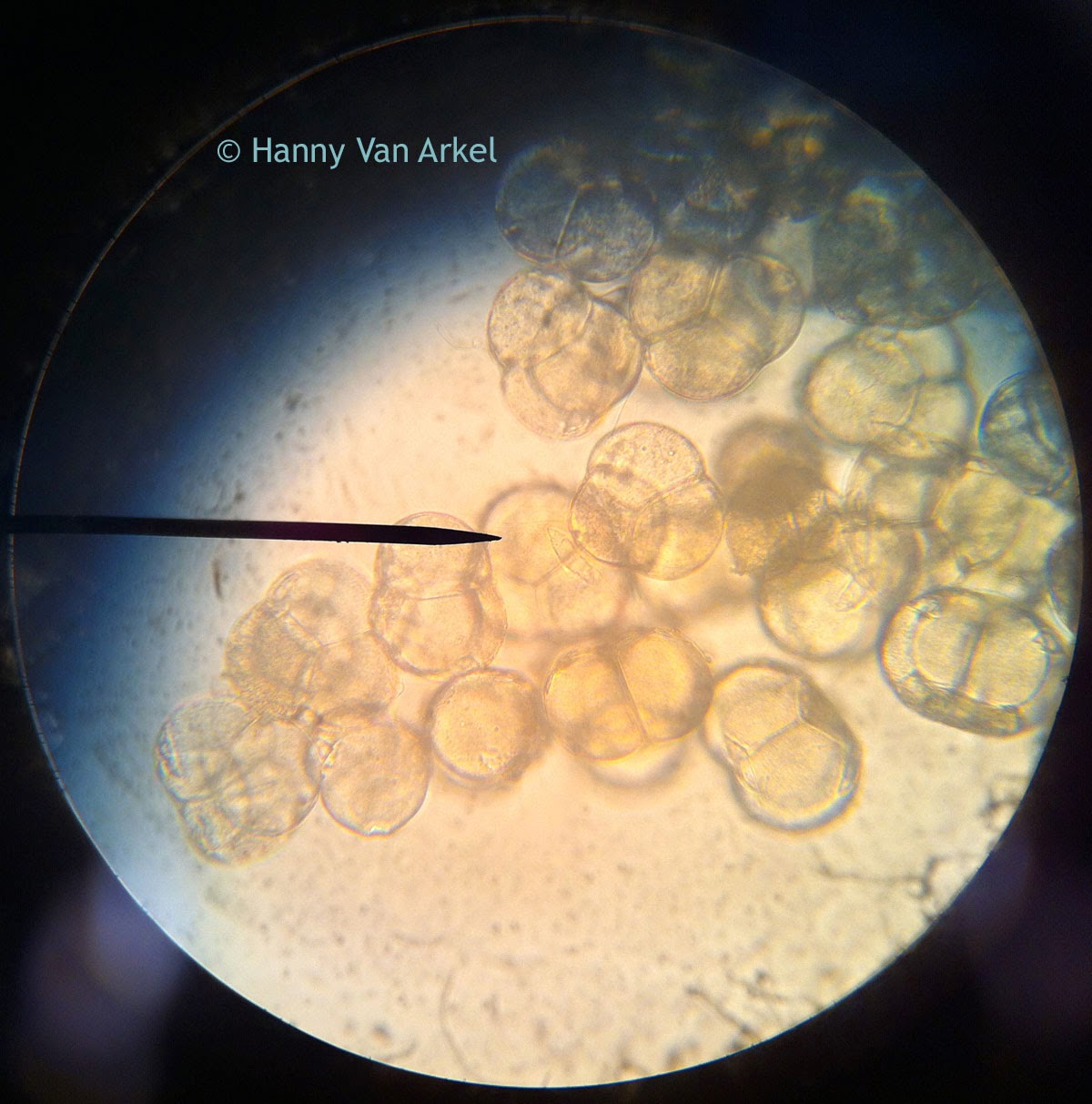 Pollen under the microscope at 400x