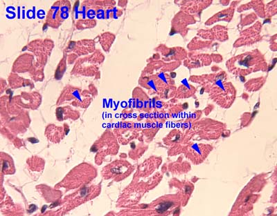 HISTOLOGY PICTURES: Muscle