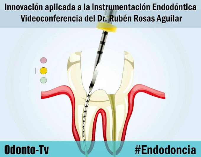 WEBINAR: Innovación aplicada a la instrumentación Endodóntica - Dr. Rubén Rosas Aguilar