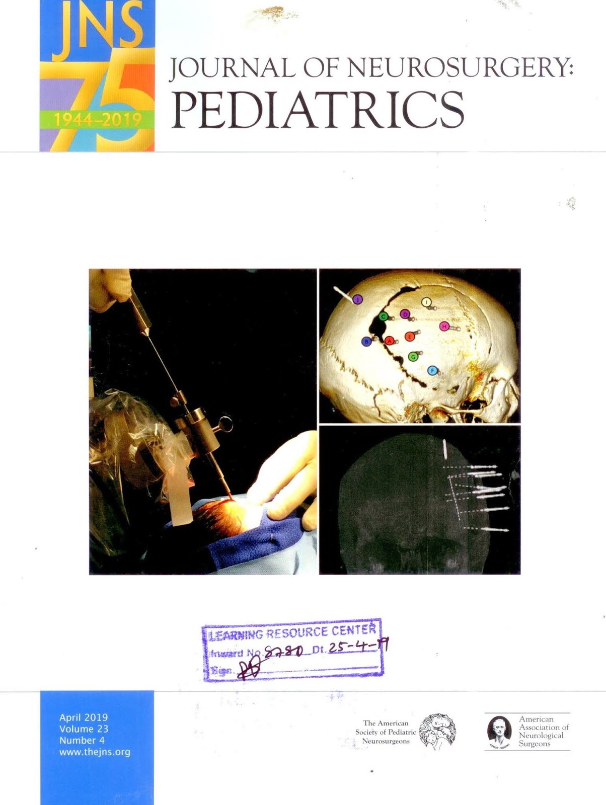 https://thejns.org/pediatrics/abstract/journals/j-neurosurg-pediatr/23/4/j-neurosurg-pediatr.23.issue-4.xml
