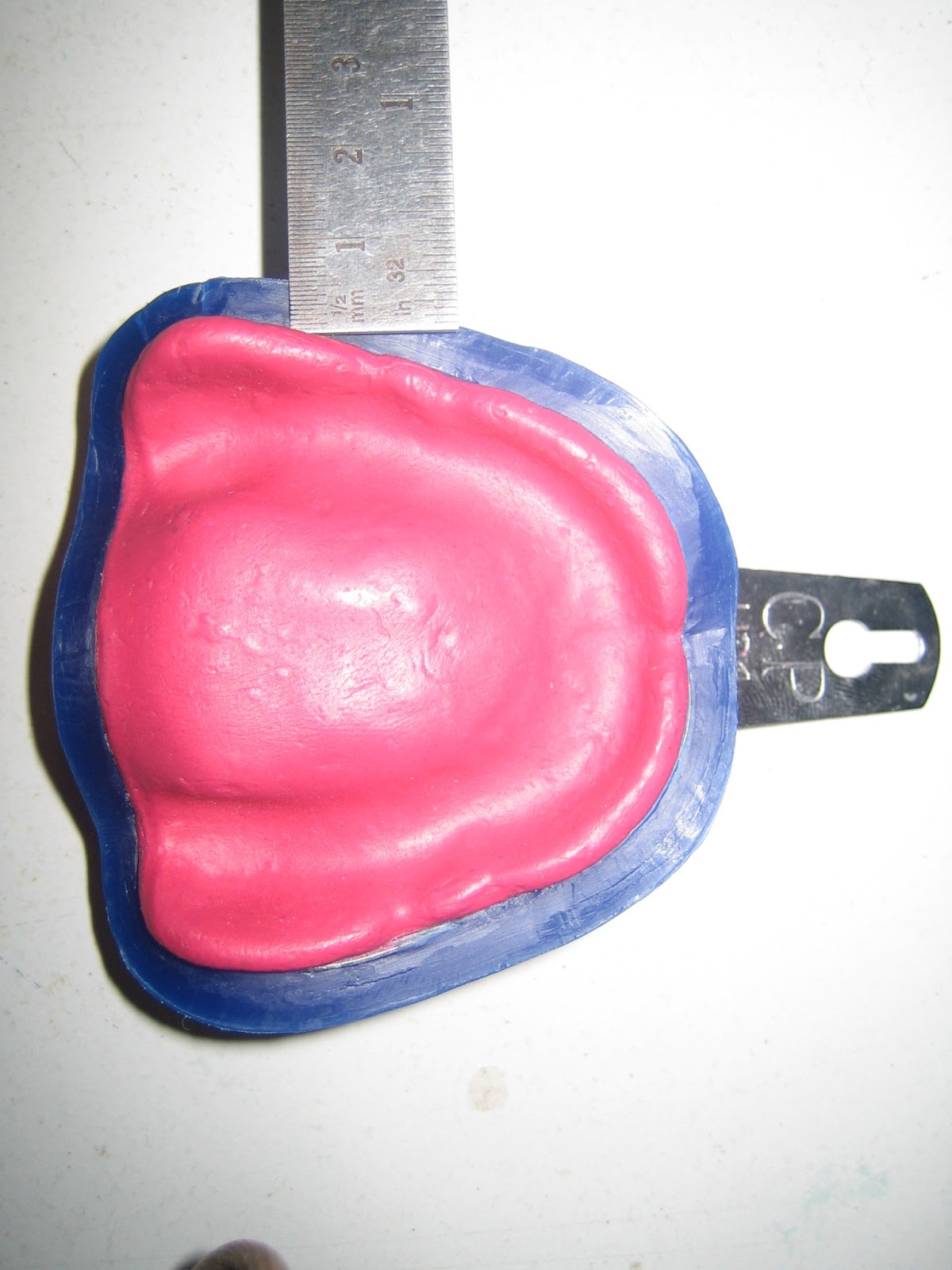 Understanding Prosthodontics Tagore Dental College & HospitalBy