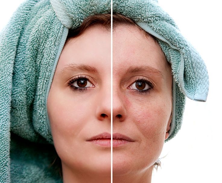 Exploring Various Ways to Reverse Skin Damage iena lifestyle blogger