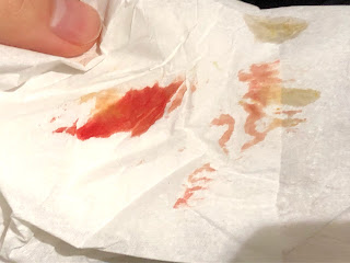 京科学者のキレイになる実験ほか ブログ内神庭研究室 実は九死に一生 ガン 消化管カルチノイド腫瘍 を偶然取り除けたかもしれない件 内視鏡手術 321