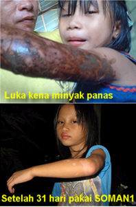 SoMan - Testimoni Olivia SoMan - Testimoni Olivia