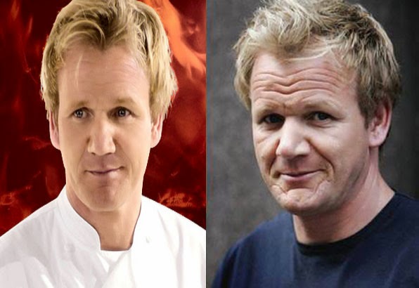 Gordon Ramsay Plastic Surgery Facelift Before and After (Star plastic ...