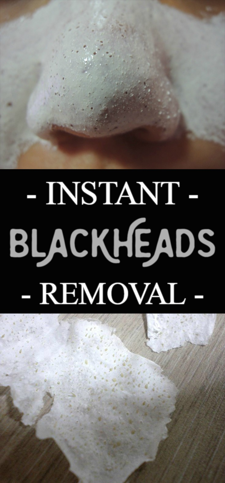 Instant blackheads removal HEALTHYLIFE