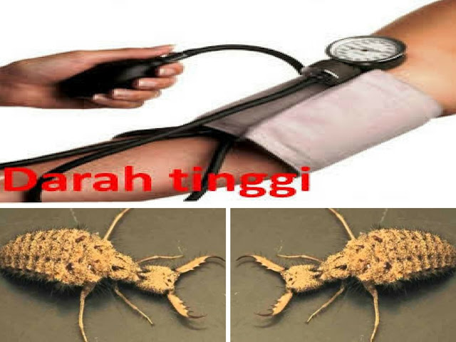 Jarang Diketahui..!! Undur-Undur Dapat Sembuhkan Penyakit Berbahaya.. Jarang Diketahui..!! Undur-Undur Dapat Sembuhkan Penyakit Berbahaya..