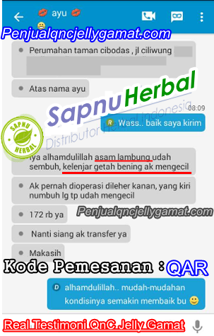 Cara Menghilangkan Kelenjar Getah Bening Pada Anak Mujarab Cara Menghilangkan Kelenjar Getah Bening Pada Anak Mujarab