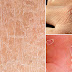 7 Odd Homemade Tricks To Get Rid Of Dry Skin Quickly!