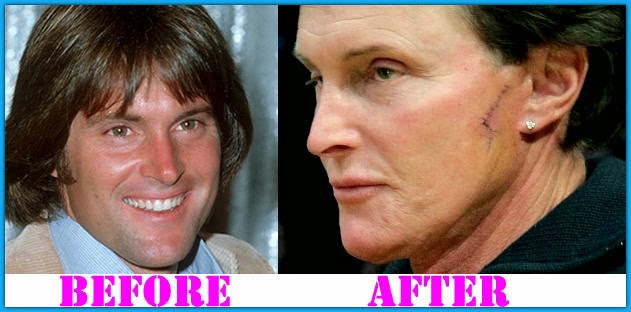 Plastic Surgery Before And After