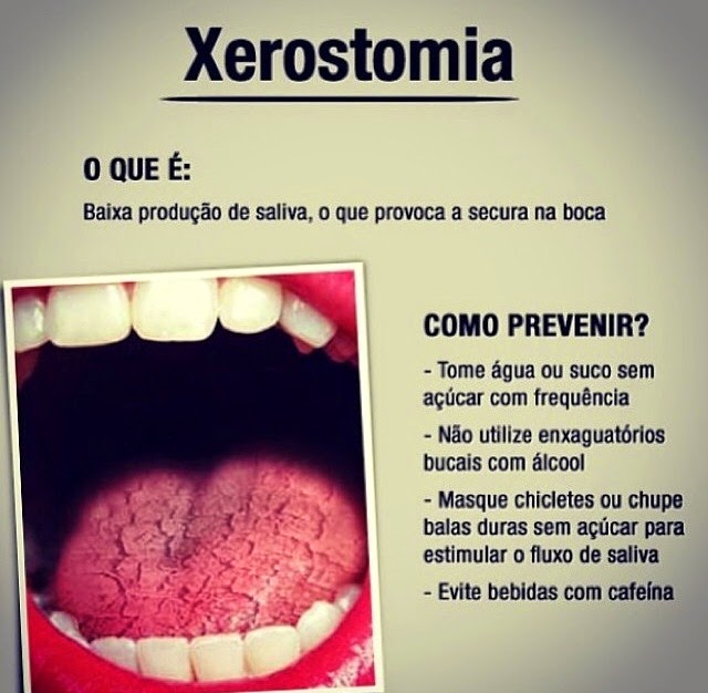 A Respeito Da Xerostomia é Correto Afirmar Que
