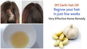 Garlic For Hair Growth Know The Ways To Use Garlic For Hair Growth