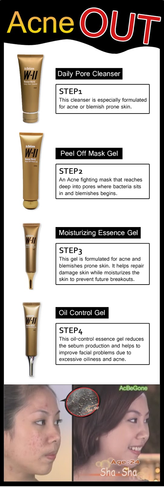 WII AcBeGone Set (P2,980)