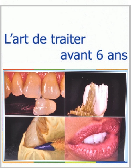 Livre : L'art de traiter avant 6 ans - Adrian LUSSI PDF Livre : L'art de traiter avant 6 ans - Adrian LUSSI PDF