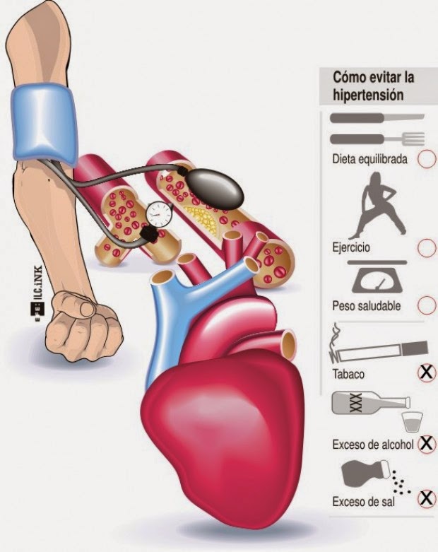 De Hipertensión Biodescodificacion H De Hipertensión Biodescodificacion H