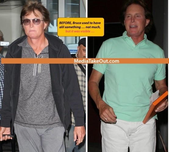 Lol. MTO claims Bruce Jenner has had his &lsquo;junk&rsquo; surgically removed