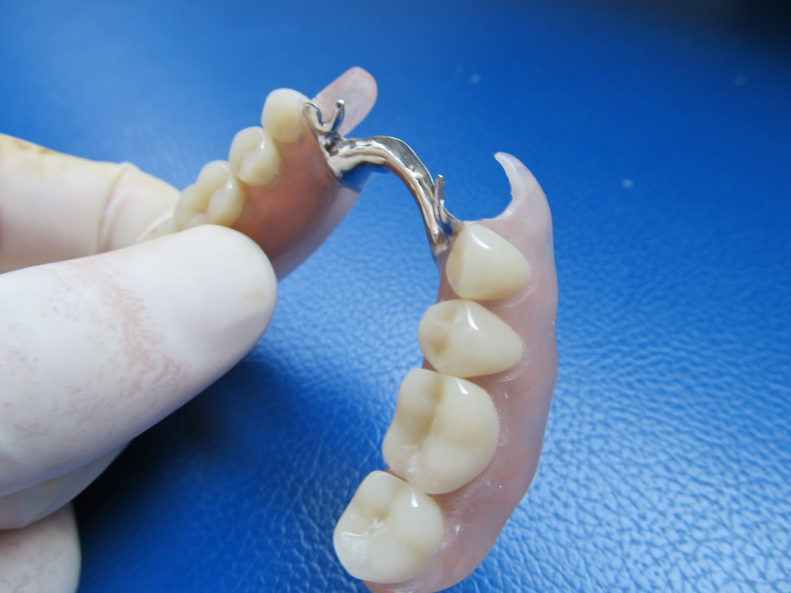 Tecnica De Articulacion En Protesis Dental