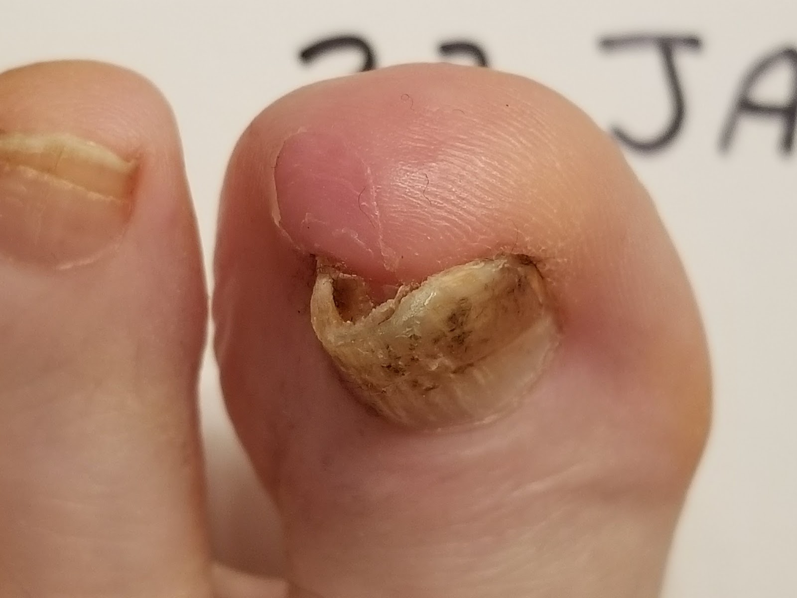 big toe nail design 2024