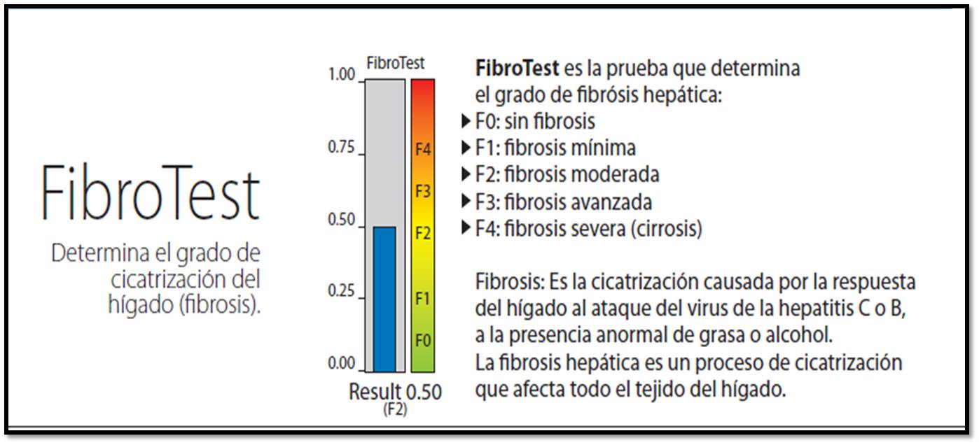 Fibrotest Components Quels Sont Les Inconvénients Du Fibrotest – DGAM