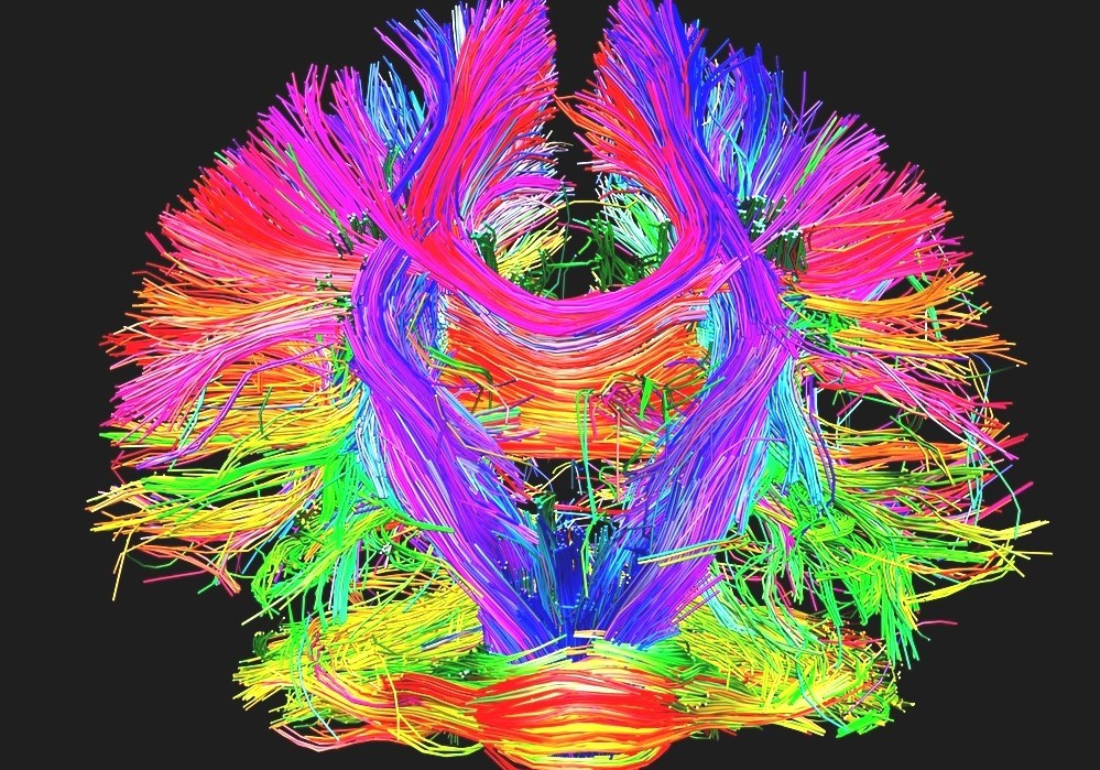 Brain Mapping Map Of The Human - Brain%2BMapping%2B %2BMap%2BOf%2BThe%2BHuman%2BBrain 795315