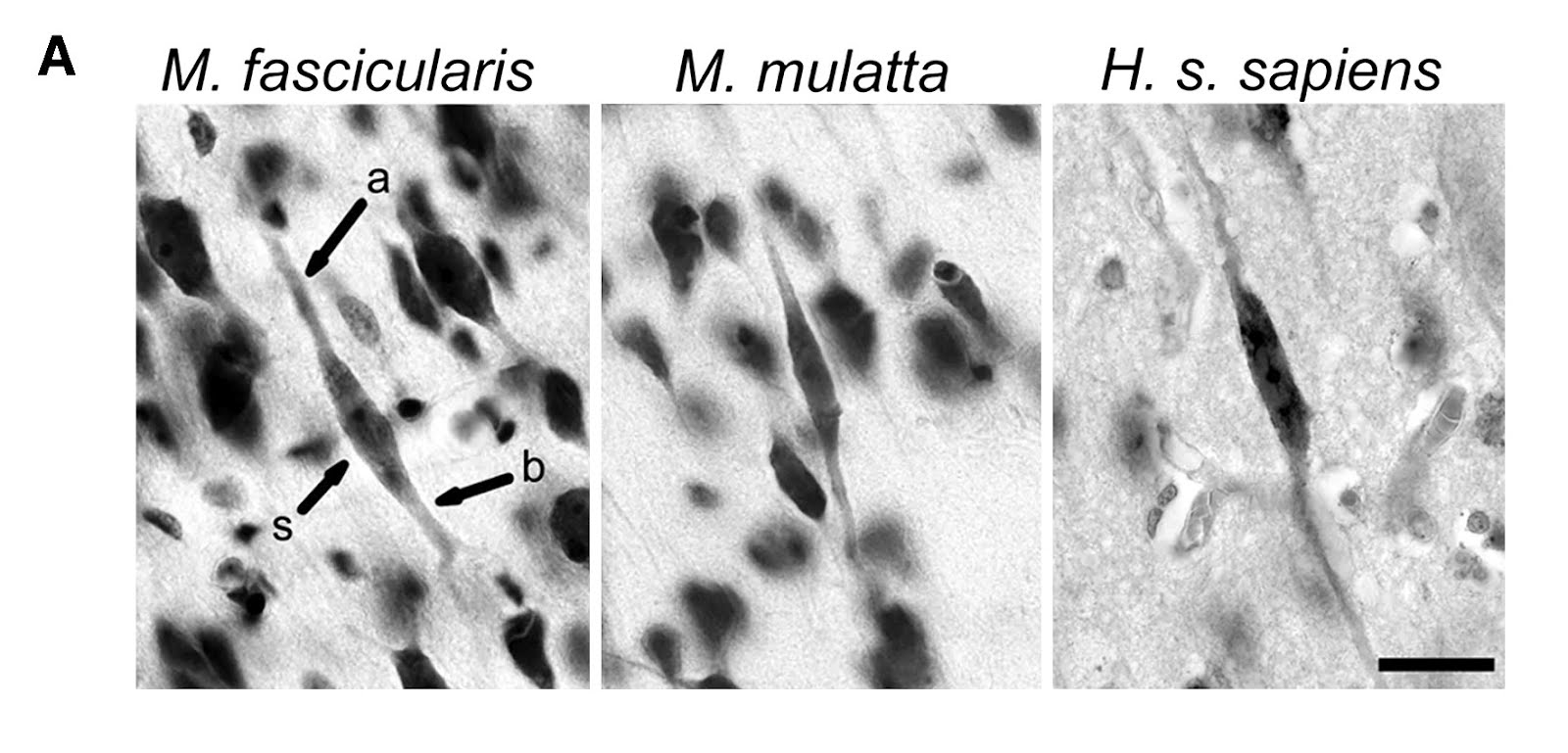 The Neurocritic Spindle Neurons in Macaques?