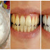 Prevent Tooth Decay, Protect Your Enamel, And Make Your Teeth White And Strong Only With One Ingredient