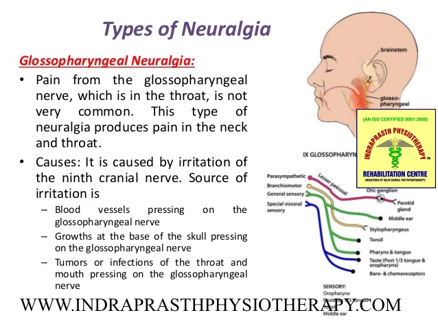 INDRAPRASTH PHYSIOTHERAPY CENTRE: GLOSSOPHARYNGEAL NEURALGIA
