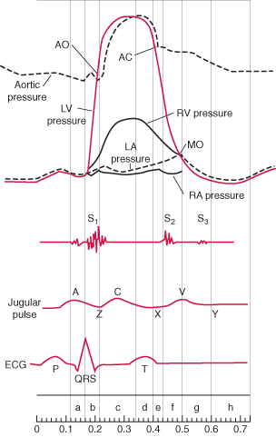 HUMAN PHYSIOLOGY: CARDIAC CATHERIZATION