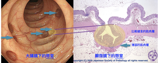 トラタミエント