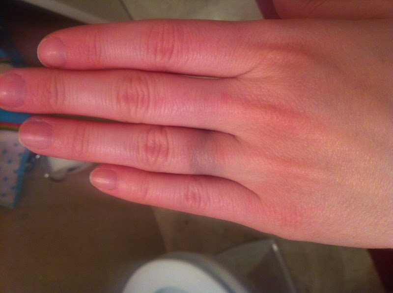 lovely lost things guess who's allergic to rose gold...