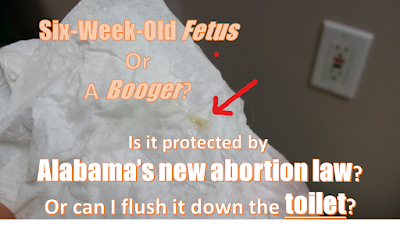 Is this a 6-week-old fetus or a booger? Is it protected by the Alabama abortion law, or can I flush it down the toilet? Image of booger in tissue that looks like 6-week-old fetus