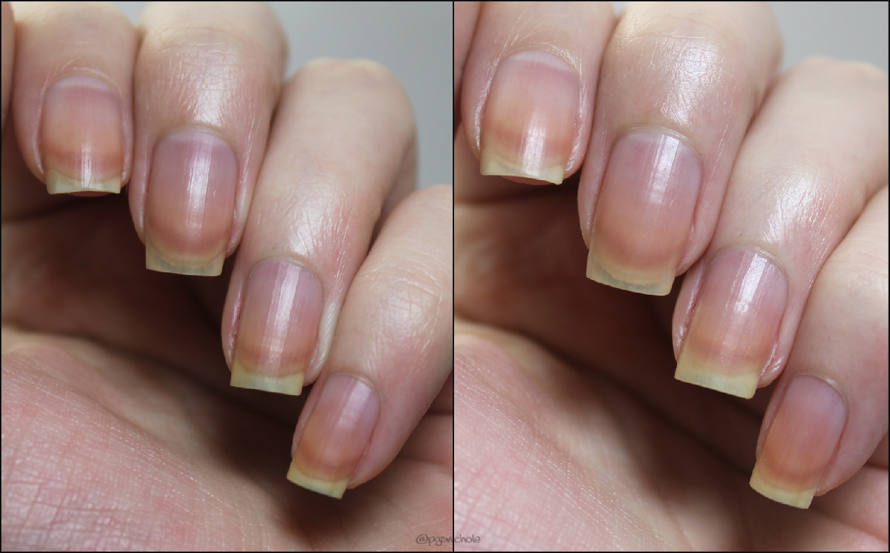 Pin Busting Denture Tablets for Yellow Nails Pretty Girl Science