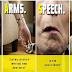 5 Early But Dangerous Signs Of Stroke Before It Actually Happens, This Could Save Lives