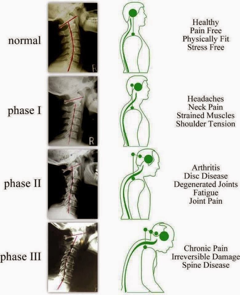 Commit From Head to Toe Work Through It Neck Pain