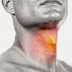 characteristic feature of inflammation of the throat characteristic feature of inflammation of the throat