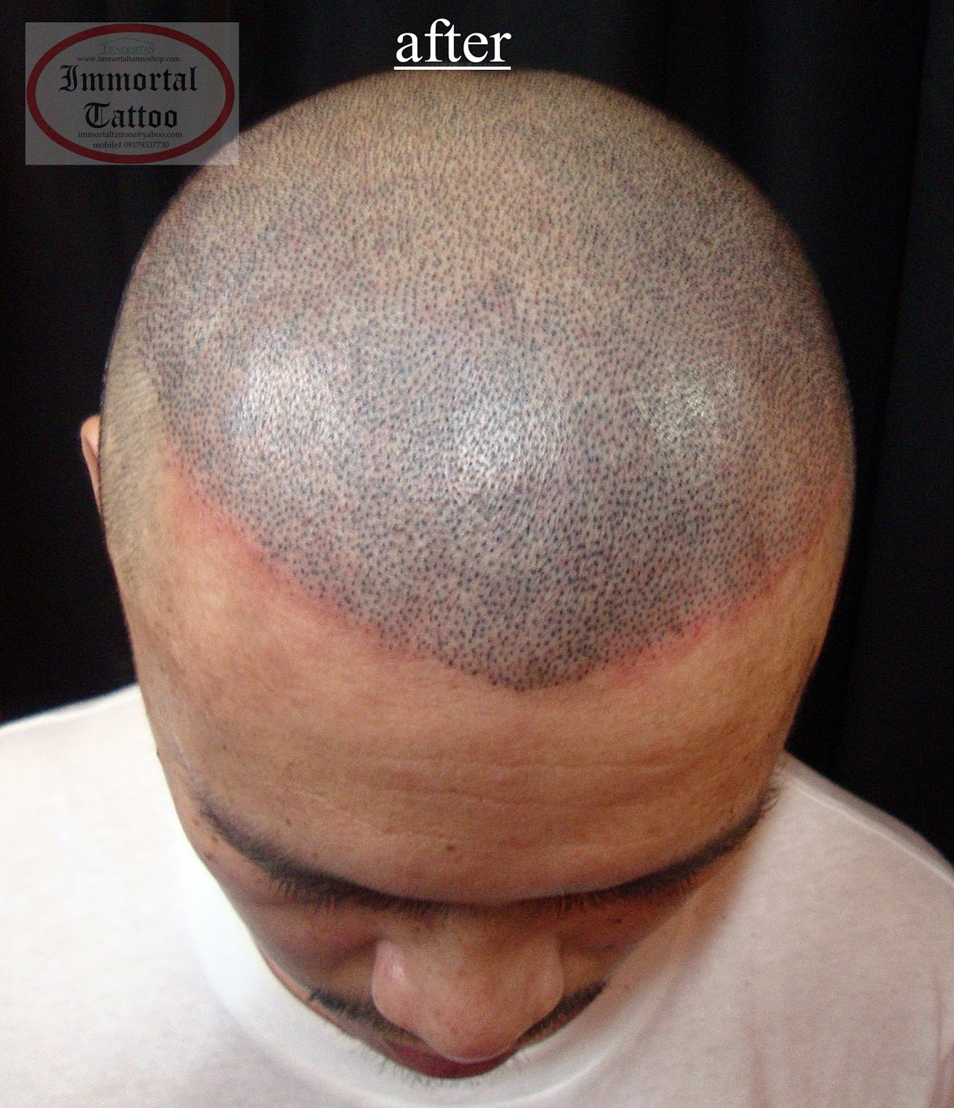 Immortal Tattoo Manila Philippines By Frank Ibanez Jr May 2016