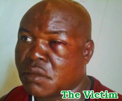 man beaten by prophet