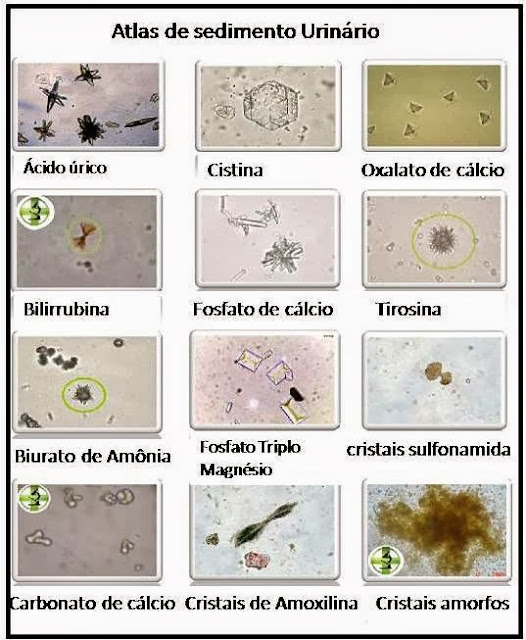 DICAS PELUDAS CRISTAIS NA URINA E CÁLCULOS URINÁRIOS EM CÃES DICAS PELUDAS CRISTAIS NA URINA E CÁLCULOS URINÁRIOS EM CÃES