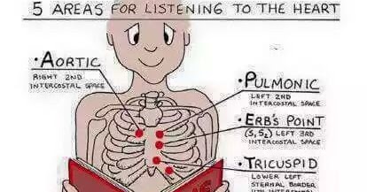 medical notes: areas of heart auscultation