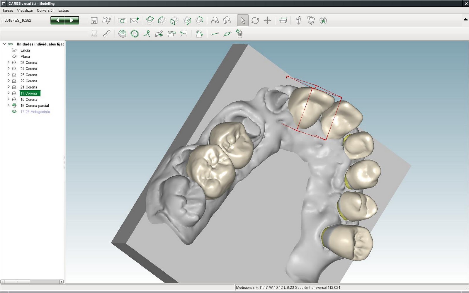 Odontología sin chorradas: CAD-CAM, suena muy tecnológico... Parte 1.