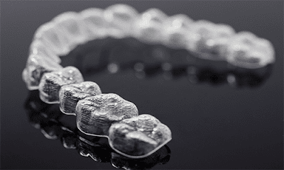 ban-hieu-gi-ve-invisalign