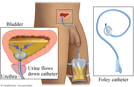 ÎÏοÏÎλεÏμα εικÏÎ½Î±Ï Î³Î¹Î± ÎΥΡÎÎÎÎÎΤÎΡΠFOLEY