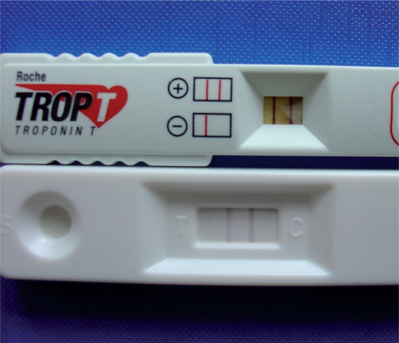 Biochemistry Class notes Cardiac Troponin I (cTnI) assay by
