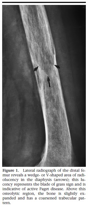 Ultimate Radiology : 'Semiology' - The Signs in Radiology