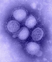 VÍRUS H1N1 (ampliado)